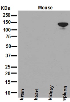 NEDD4-2 NEDD4L/NEDD4 Rabbit Monoclonal Antibody