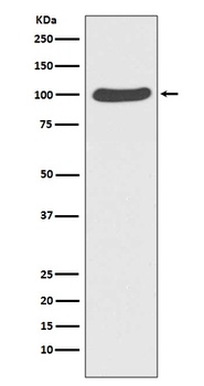 Catenin alpha 1 CTNNA1 Rabbit Monoclonal Antibody