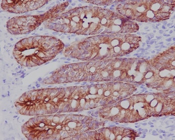 Cytokeratin 19/KRT19 Rabbit Monoclonal Antibody