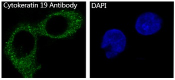 Cytokeratin 19/KRT19 Rabbit Monoclonal Antibody