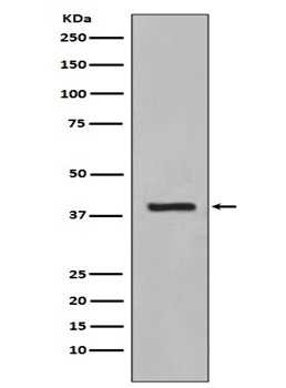 Cytokeratin 19/KRT19 Rabbit Monoclonal Antibody