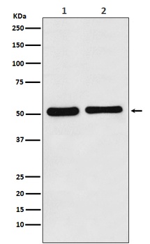 Fascin Rabbit Monoclonal Antibody