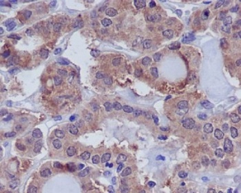 DUSP6/Mkp 3 Rabbit Monoclonal Antibody