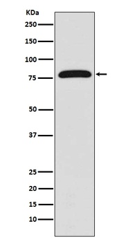TGM2/Transglutaminase 2 Rabbit Monoclonal Antibody
