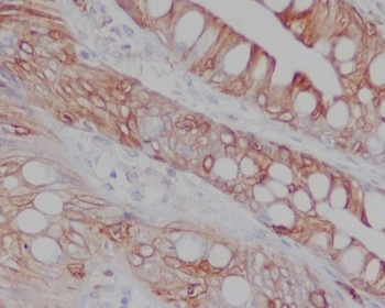 CD8 CD8A Rabbit Monoclonal Antibody