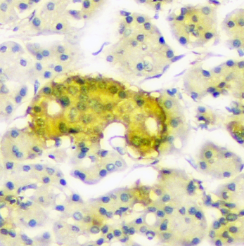 ATP citrate lyase ACLY Antibody (monoclonal, 5I2)