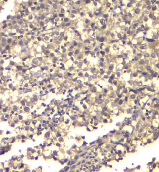 ATP citrate lyase ACLY Antibody (monoclonal, 5I2)