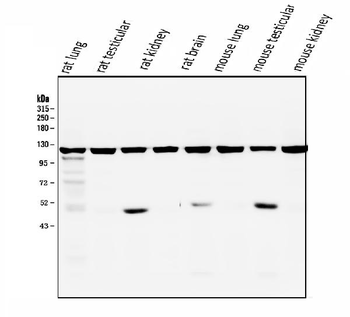 ATP citrate lyase ACLY Antibody (monoclonal, 5I2)