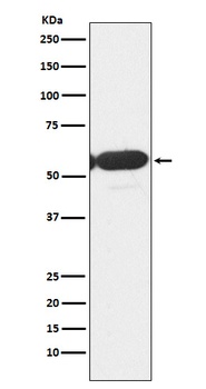 PFKFB3 Rabbit Monoclonal Antibody