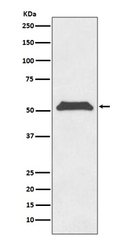 TRF1 TERF1 Rabbit Monoclonal Antibody
