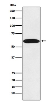 STIP1 Rabbit Monoclonal Antibody