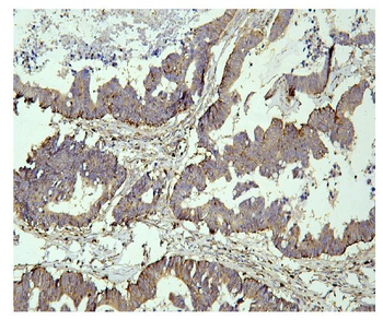 PPT1 Mouse Monoclonal Antibody