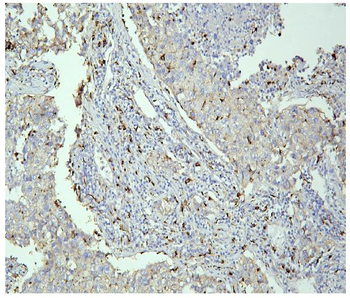 PPT1 Mouse Monoclonal Antibody