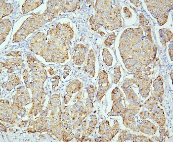 PPT1 Mouse Monoclonal Antibody