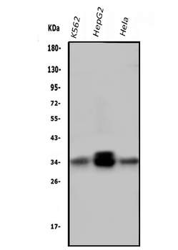 PPT1 Mouse Monoclonal Antibody