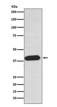 EDG2 LPAR1 Rabbit Monoclonal Antibody