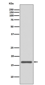 AGR2/Ag 2 Rabbit Monoclonal Antibody