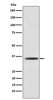 Myogenin Rabbit Monoclonal Antibody