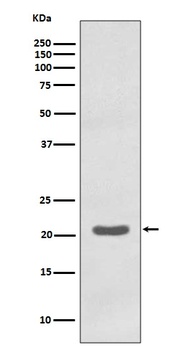 MTCO2 Rabbit Monoclonal Antibody