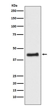 COUP TF1 NR2F1 Rabbit Monoclonal Antibody