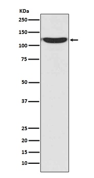 PKN2/Prk2 Rabbit Monoclonal Antibody