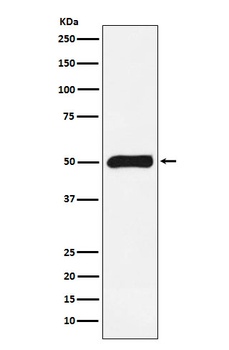 FKBP51 Rabbit Monoclonal Antibody
