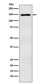 MYBBP1A Rabbit Monoclonal Antibody