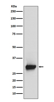 Calretinin Rabbit Monoclonal Antibody