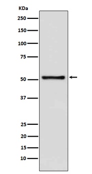 TDT DNTT Rabbit Monoclonal Antibody