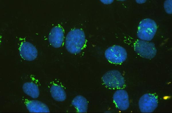 GM130 GOLGA2 Mouse Monoclonal Antibody