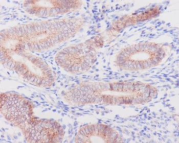 Flotillin 1/FLOT1 Rabbit Monoclonal Antibody