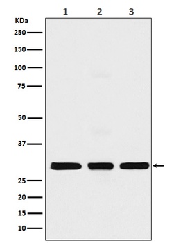 Histone H1.2 Rabbit Monoclonal Antibody