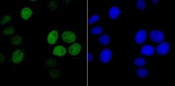 Histone H1.2 Rabbit Monoclonal Antibody