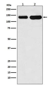 K-Cadherin-6 CDH6-/CDH6 Rabbit Monoclonal Antibody