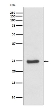 ZNRF2 Rabbit Monoclonal Antibody