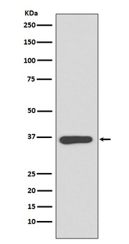 Annexin A10 Rabbit Monoclonal Antibody