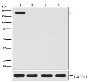 CRISPR-Cas9 SP/CRISPR Rabbit Monoclonal Antibody