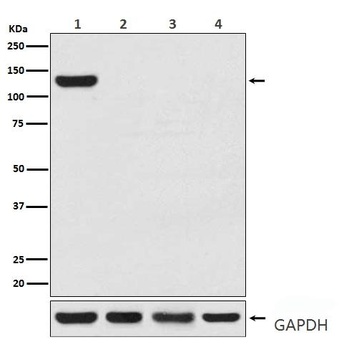CRISPR-Cas9/CRISPR Rabbit Monoclonal Antibody