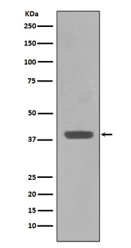 Maltose Binding Protein malE Rabbit Monoclonal Antibody
