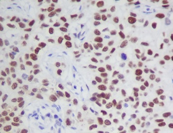Phospho-JAK2 (Y1007 + Y1008) Monoclonal Antibody