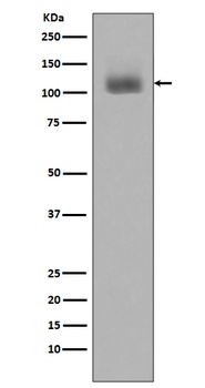 Phospho-JAK2 (Y1007 + Y1008) Monoclonal Antibody