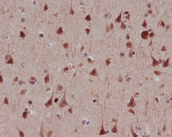Phospho-MSK1 RPS6KA5/MSK1 Rabbit Monoclonal Antibody