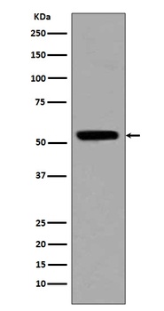 p53 TP53 Rabbit Monoclonal Antibody