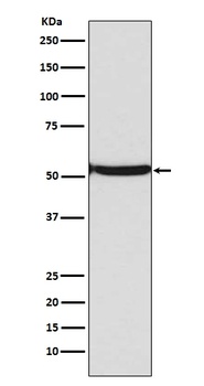 p53 TP53 Rabbit Monoclonal Antibody