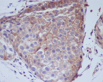 Phospho-EGFR/EGFR Rabbit Monoclonal Antibody