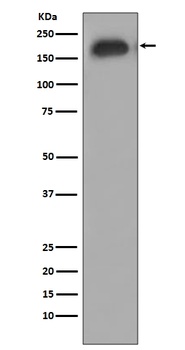 Phospho-EGFR/EGFR Rabbit Monoclonal Antibody
