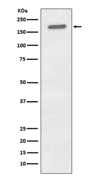 Phospho-EGFR/EGFR Rabbit Monoclonal Antibody