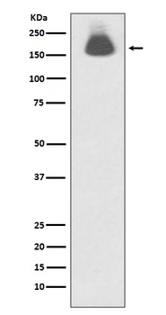 Phospho-EGFR/EGFR Rabbit Monoclonal Antibody