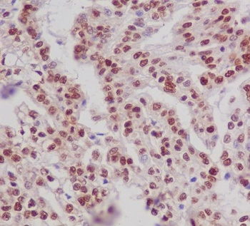 Phospho-ER alpha (S118) ESR1 Rabbit Monoclonal Antibody