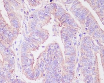 Phospho-FoxO3a Rabbit Monoclonal Antibody